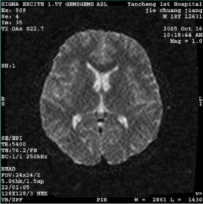 ARTIFACT WI/Fiesta Image White Pixel ARTIFACT WI/Fiesta Image White Pixel